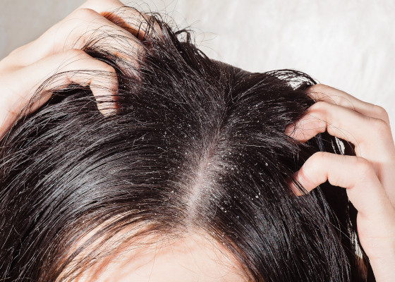 cheveux_normaux_2
